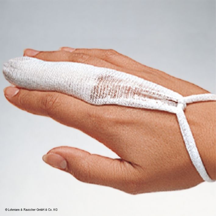 tg-Fingerlinge (50 Stck.)UK = 15 Pack02042023