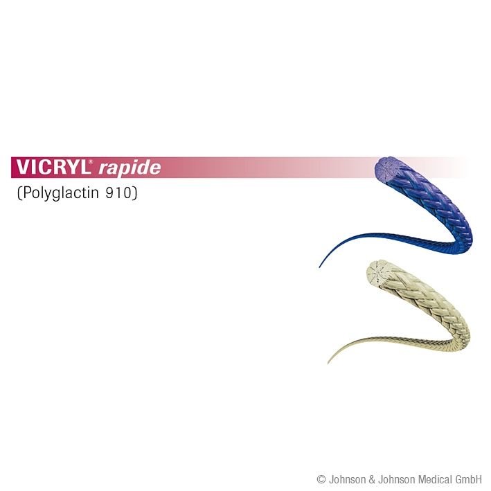 VICRYL rapide X1 3/0=2 ungefärbtNahtmaterial Fadenlänge 45 cm (36 Stck.)geflochten
